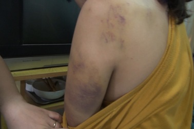 Thiếu nữ bị chặt ngón tay, chích điện ép bán dâm