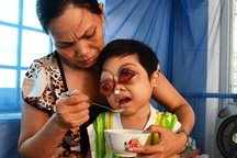 Ám ảnh đôi mắt muốn nổ tung của cháu bé 5 tuổi 