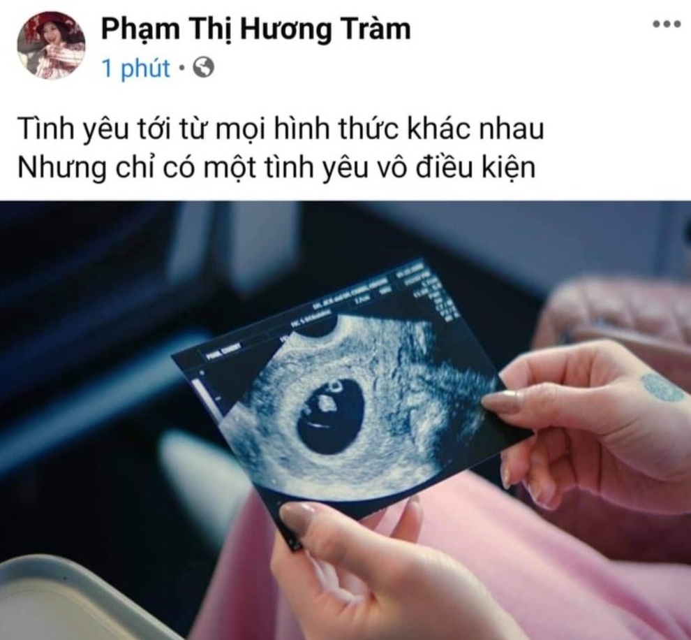 Hương Tràm: Tôi độc thân và sẵn sàng cho mối quan hệ mới - 2 Hương Tràm: Tôi độc thân và sẵn sàng cho mối quan hệ mới - 2