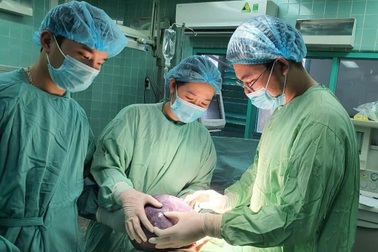 Cắt bỏ khối u nặng gần 5kg cho thiếu nữ 17 tuổi người dân tộc