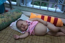 Sự sống mong manh của bé gái 2 tuổi bị ung thư mô tế bào