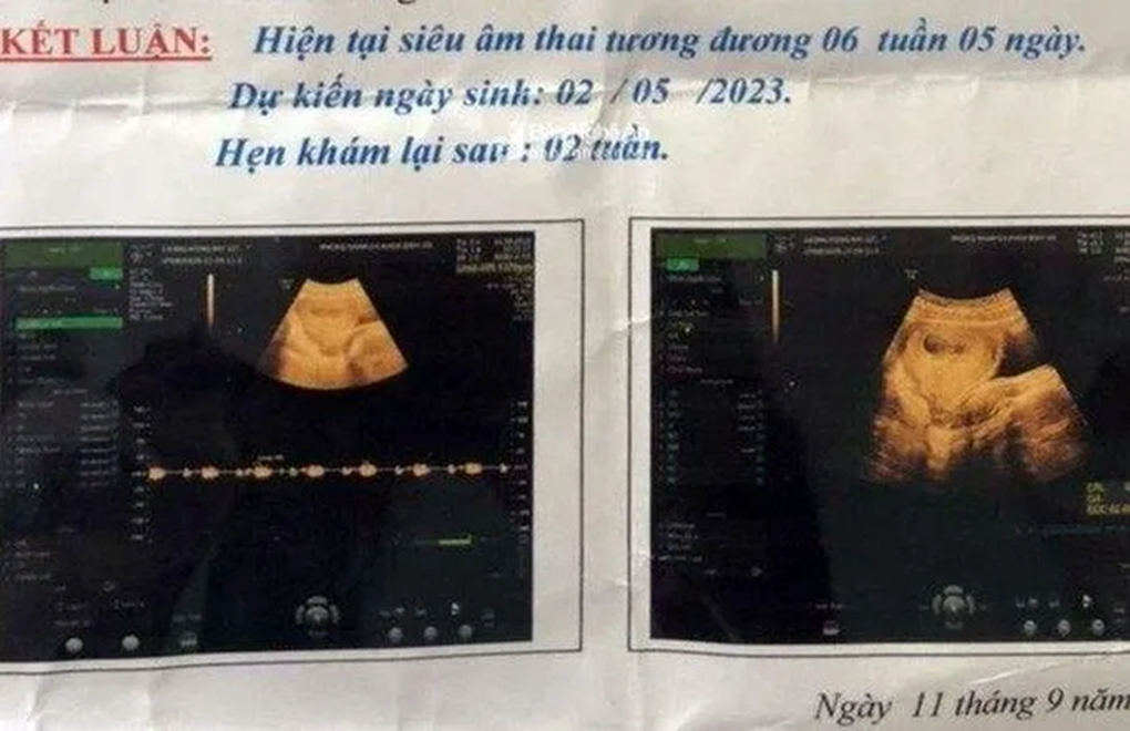 Bảo vệ trường học xâm hại khiến nữ sinh lớp 6 mang thai đối mặt 20 năm tù? - 1 Bảo vệ trường học xâm hại khiến nữ sinh lớp 6 mang thai đối mặt 20 năm tù? - 1