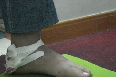 Thấy ngứa, đừng vội gãi!