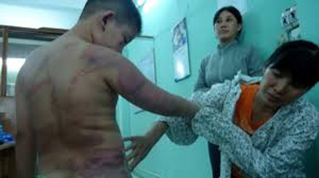Tang thương dưới những mái nhà: Bạo lực đe dọa giá trị gia đình Việt - 3 Tang thương dưới những mái nhà: Bạo lực đe dọa giá trị gia đình Việt - 3