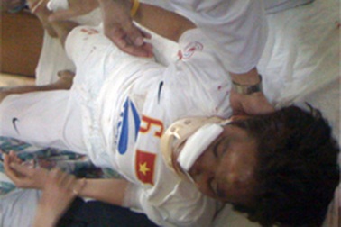 Ngã từ tầng 3, nữ tuyển thủ Kim Tiến chấn thương nặng 