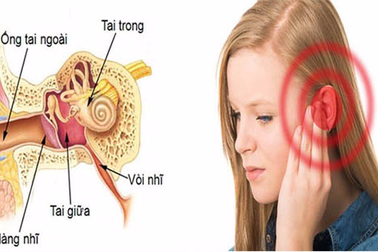 Các nguyên nhân gây đau tai và cách xử trí
