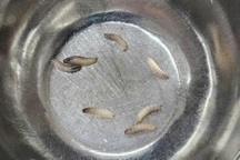 Bác sĩ gắp 7 con dòi từ mũi người phụ nữ 60 tuổi