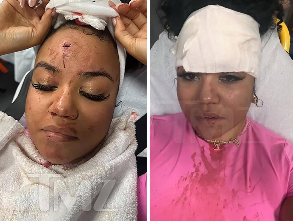 Ném micro gây thương tích cho khán giả, rapper bị điều tra tội hành hung - 1 Ném micro gây thương tích cho khán giả, rapper bị điều tra tội hành hung - 1