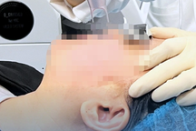 Vụ nguy kịch sau ủ tê làm da: Thanh tra Sở Y tế TPHCM kiểm tra thẩm mỹ viện