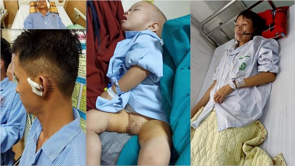 Người đàn ông mắc bệnh lạ bị ăn mòn xương não được bạn đọc giúp đỡ hơn 42 triệu đồng - 1 Người đàn ông mắc bệnh lạ bị ăn mòn xương não được bạn đọc giúp đỡ hơn 42 triệu đồng - 1