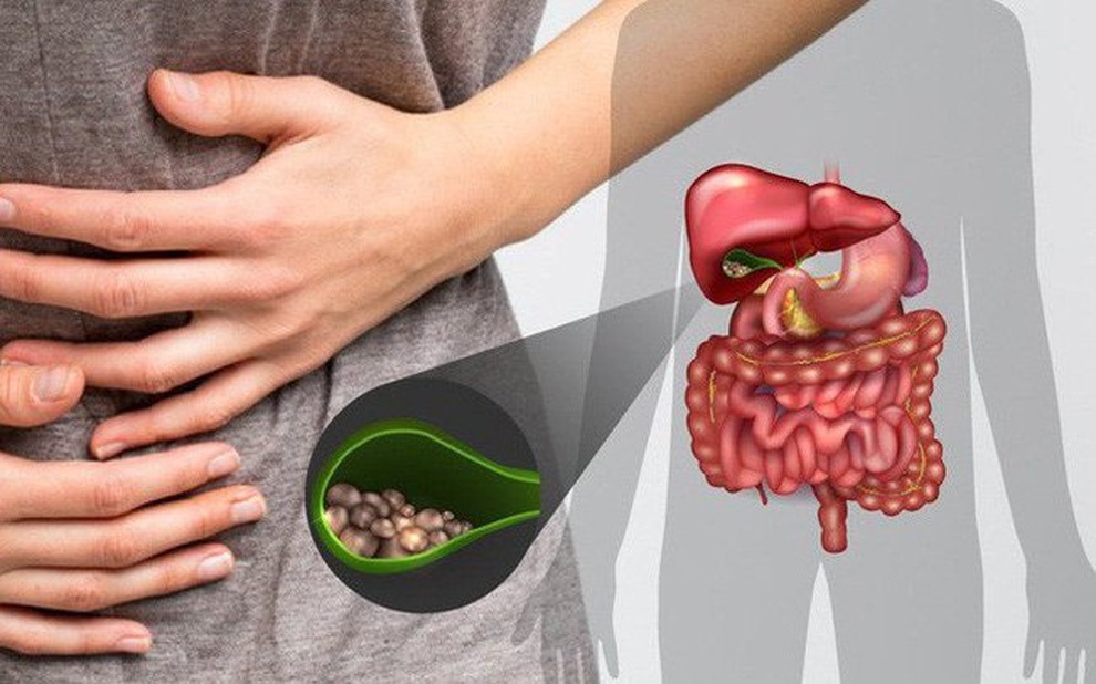 Ung thư túi mật khó phát hiện ở giai đoạn sớm - 1 Ung thư túi mật khó phát hiện ở giai đoạn sớm - 1