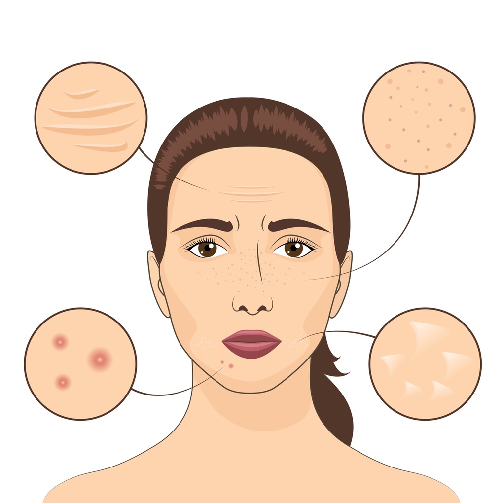 Collagen - Bí quyết giúp lưu giữ nét thanh xuân cho phái đẹp - 1 Collagen - Bí quyết giúp lưu giữ nét thanh xuân cho phái đẹp - 1