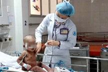 TPHCM: Cha mẹ xông hơi trị Covid-19 cho con, nhiều trẻ bỏng nặng thương tâm