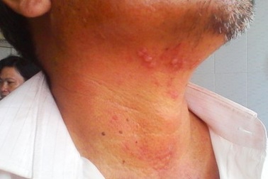 Trưởng Công an xã bị “tố” xịt hơi cay vào mắt dân