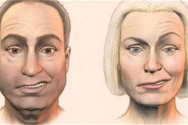 Trúng gió méo miệng nhưng nguy hiểm cho mắt