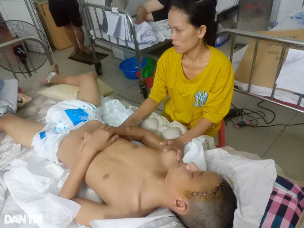 Tranh thủ đi làm thêm dịp hè phụ cha mẹ, nam sinh lớp 11 gặp nạn nguy kịch - 4 Tranh thủ đi làm thêm dịp hè phụ cha mẹ, nam sinh lớp 11 gặp nạn nguy kịch - 4