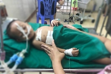 Chơi đùa với súng hơi, bé 19 tháng tuổi bị thương ở ngực