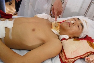 Đưa bạn về nhà, nam sinh bị đánh nguy kịch