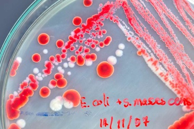 Phát triển thành công sinh vật sống với DNA được thiết kế lại hoàn toàn