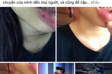 Nữ sinh “tố” anh rể bạo hành mong muốn chấm dứt sự việc, tiếp tục đến trường