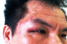 Một nhà báo bị đánh túi bụi khi đang tác nghiệp