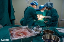 Kỹ thuật mới giúp thực hiện những ca ghép thận đặc biệt khó