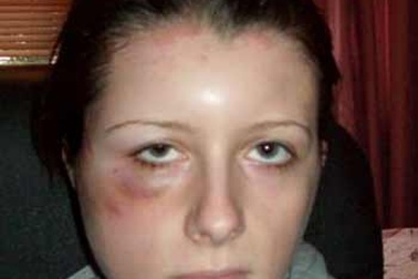 Sẽ chết nếu nhuộm tóc tiếp