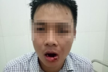 Khởi tố thầy giáo ném thanh sắt khiến nhân viên tòa… gãy 5 răng