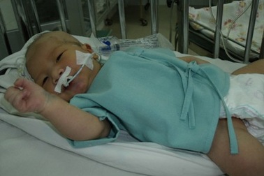 Nhân Hòa sẽ được phẫu thuật tại Nhi Đồng 2