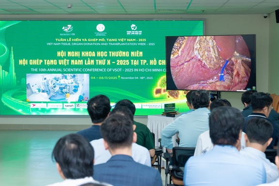 Vinmec trình diễn kỹ thuật ghép gan sống phức tạp tại hội nghị ghép tạng