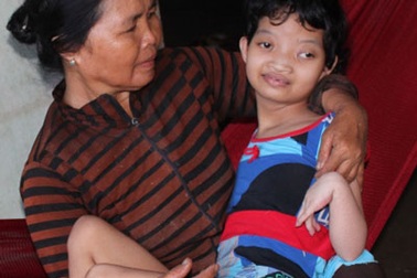 Da cam - nỗi đau bao giờ nguôi ngoai!