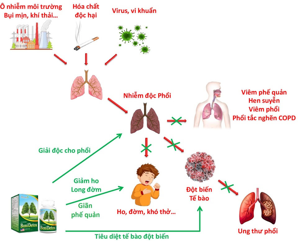 BoniDetox – Bí kíp vàng hỗ trợ giải độc phổi và giảm nguy cơ u bướu phổi của Mỹ - 3 BoniDetox – Bí kíp vàng hỗ trợ giải độc phổi và giảm nguy cơ u bướu phổi của Mỹ - 3