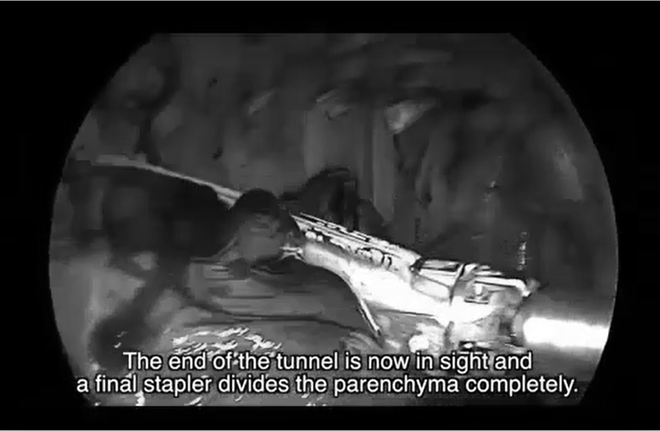Lần đầu tiên: Bác sĩ Việt Nam tham gia ca mổ ở Hàn Quốc bằng thực tế ảo - 3 Lần đầu tiên: Bác sĩ Việt Nam tham gia ca mổ ở Hàn Quốc bằng thực tế ảo - 3