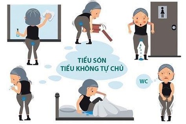 Có thực phẩm bảo vệ sức khỏe Ích Tiểu Vương, không lo tiểu són “làm phiền”