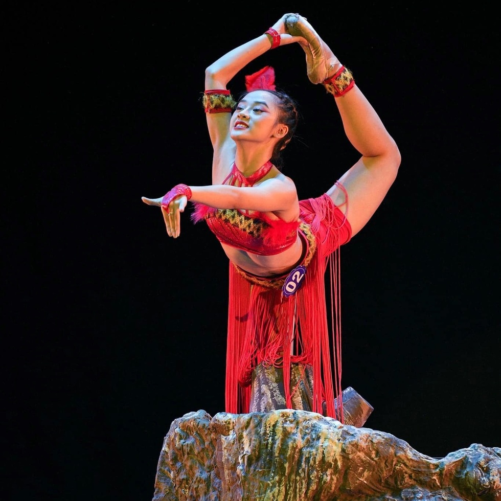 Nữ sinh Bắc Giang có hai màu mắt: Trải qua 5 lần phẫu thuật vẫn yêu đời - 5 Nữ sinh Bắc Giang có hai màu mắt: Trải qua 5 lần phẫu thuật vẫn yêu đời - 5