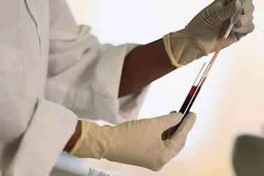 Dấu ấn ung thư - Xét nghiệm phát hiện sớm ung thư dạ dày, cổ tử cung