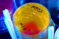 Phát hiện kháng sinh mạnh gấp 100 lần, mang hy vọng mới cho y học