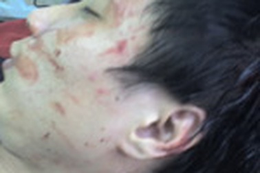 Một thanh niên ngất xỉu khi xô xát với công an phường 