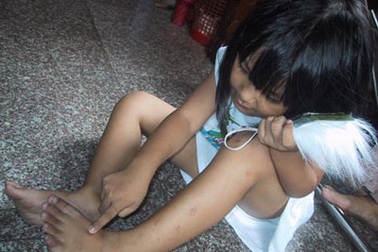 Phát hiện nhiều bọ xít hút máu ở TPHCM