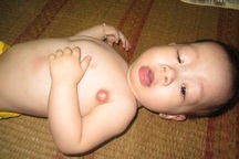 Thương cảm cháu bé có quả tim nằm bên phải