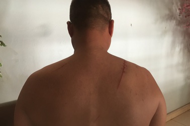 Mâu thuẫn làm ăn, giám đốc doanh nghiệp bị chém giữa ban ngày