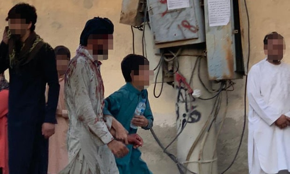 Nổ lớn rung chuyển sân bay Kabul, Taliban nói 13 người chết - 2 Nổ lớn rung chuyển sân bay Kabul, Taliban nói 13 người chết - 2