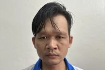 Chồng tạt cả lọ axit vào mặt vợ