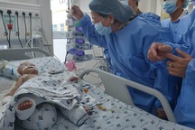 Một bé trong cặp song sinh sau tách dính đã cai được máy thở