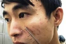 Giết người yêu trong nhà nghỉ vì mâu thuẫn