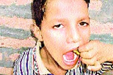 "Khắc tinh" của ong