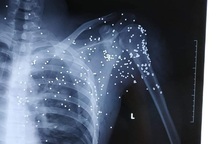 Khởi tố kẻ cầm súng hoa cải bắn người gần trạm BOT