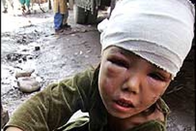 Sức sống mãnh liệt của một bé gái Pakistan mới 18 tháng tuổi