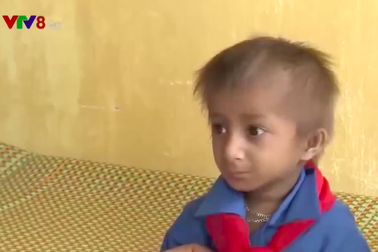 Chuyện “cổ tích” về cậu bé mắc chứng bệnh lạ, 10 tuổi nặng có 4kg