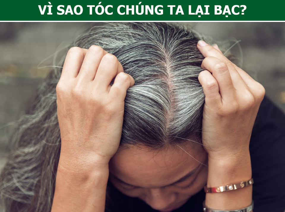 Bạc tóc vì căng thẳng, buồn phiền là hoàn toàn có thật - 2 Bạc tóc vì căng thẳng, buồn phiền là hoàn toàn có thật - 2